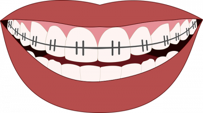orthodontiste le bourget